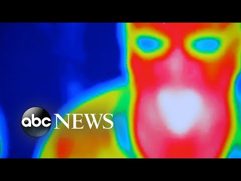 Breast cancer survivor shares cautionary tale about thermography | GMA