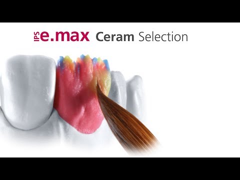 IPS e.max Ceram Selection