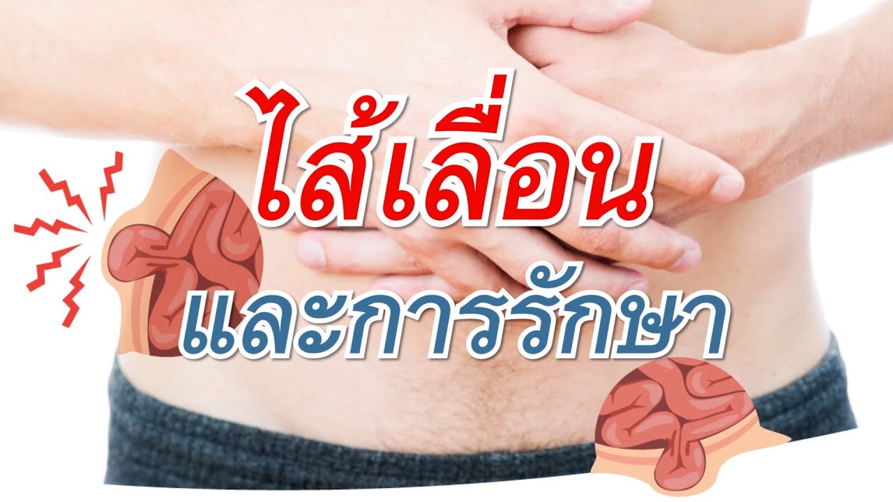 ไส้เลื่อน คืออะไร?