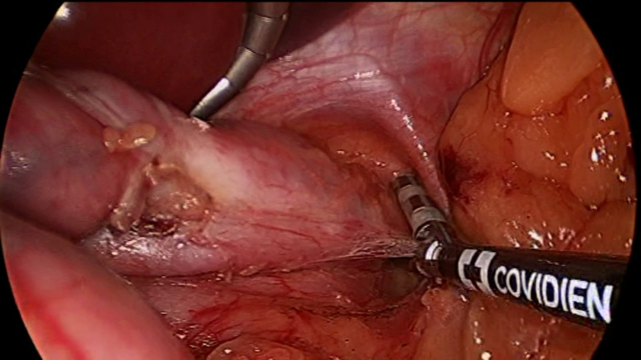 Xavier Botet Del Castillo-8