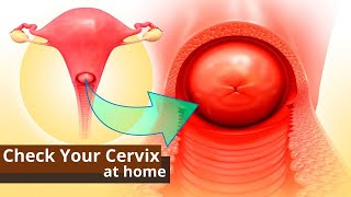 How You Can Check Your Cervix At Home | Best Ways to Know the Dilation of Cervix