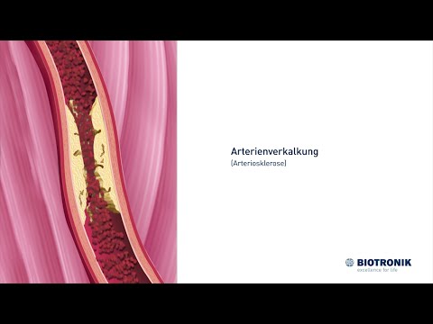 Die geholfen haben für Schmerzen im Nacken zu massieren Dass Abstrich für Rückenschmerzen