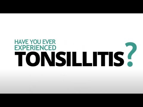Have you ever experienced tonsillitis?