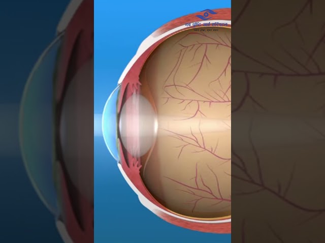 नजिकको अक्षर किन देखिँदैन? Presbyopia के हो? | Neha Shah