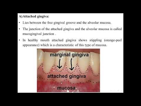 types of oral mucosa 1 2022