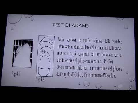Sudorazione e osteocondrosi Ginnastica per la sporgenza della colonna cervicale