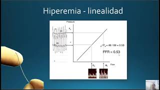 Cardiopatía isquémica (Parte 3)