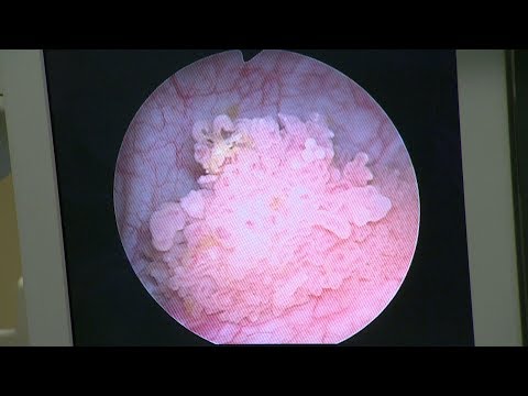 Alle von der Knieverletzung Schwäche der Bauchschmerzen und den unteren Rücken und in den Kopf