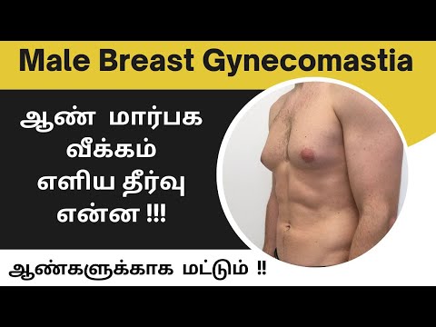 ஆண்  மார்பக வீக்கம் எளிய தீர்வு என்ன !!! Male Breast Gynecomastia | Explain With Dr.Ashok