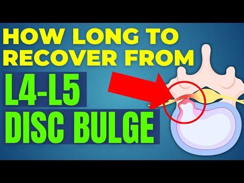 L4-L5 Disc Bulge Recovery: How Long Until You Feel Better? | Dr. Kevin Wafer