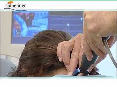 Schmerzen in den Gelenken und Füßen MR Muster von degenerativen Veränderungen in der Halswirbelsäule Osteochondrose
