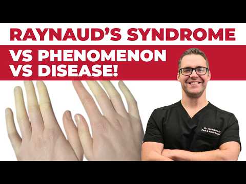 Butcher s Broom Extract Supplement Dosage Side Effects