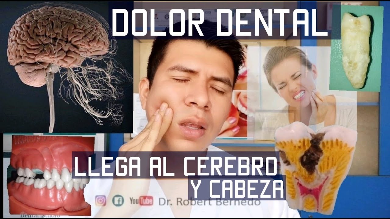 DOLOR DENTAL QUE LLEGA AL CEREBRO/ CABEZA. POR QUÉ SUCEDE CÓMO EVITARLO 🦷😨 NERVIO DENTAL/🦷 JUICIO