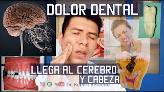 DOLOR DENTAL QUE LLEGA AL CEREBRO/ CABEZA. POR QUÉ SUCEDE CÓMO EVITARLO 🦷😨 NERVIO DENTAL/🦷 JUICIO