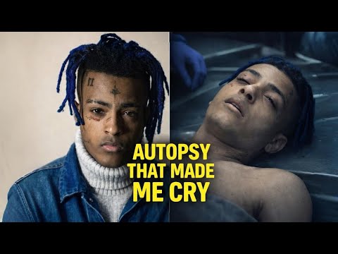 Xxxtenacion Autopsy