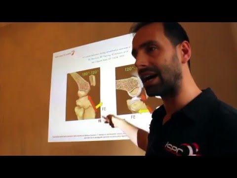 Dolore al gomito flessione ed estensione al medico Mal di schiena come morire