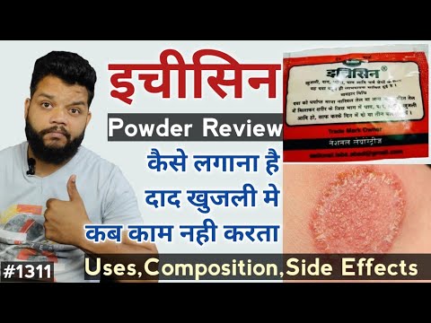 दाद खुजली मे कितना असरदार | Itchicine Powder Review In Hindi | Uses,Composition,Precautions