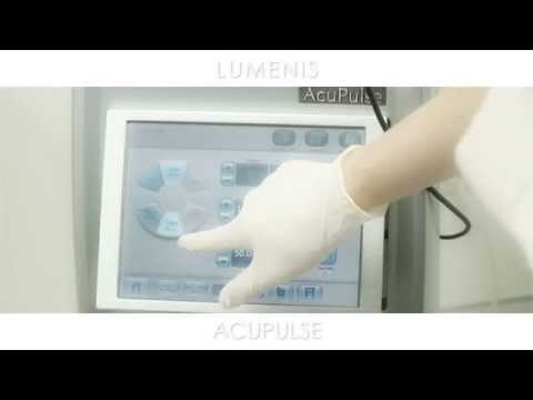 AcuPulse Laser Machine - Explainer Video | Lumenis
