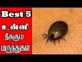 Best 5 உன்னி நீக்கும் மருந்துகள் Recommended By Doctor