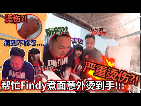 帮忙Findy煮面意外烫伤手！？