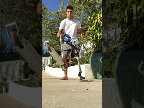 Çocukluğumuzun Scooterı Neden Tarihe Karıştı?🛴