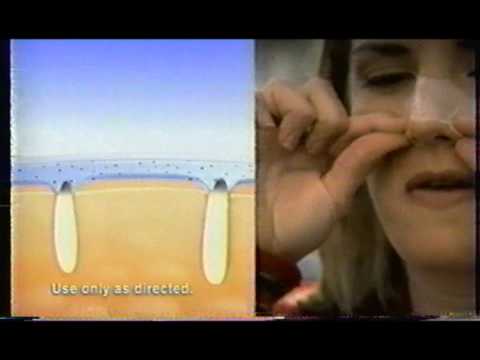 Ponds Blackhead Remover ad (1998)