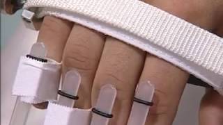 Infortunio alla mano come utilizzare il Nostro Kinetec Maestra