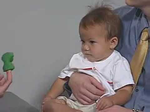 7.3 - Cranial Nerves - 12 Months - Infant Clinical Examination (MRCP)