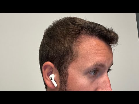 Day 196 Results - 28 Weeks Post Op Hair Transplant - Hair Texture Changing