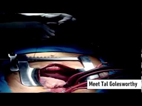 Patient Innovation - new product development