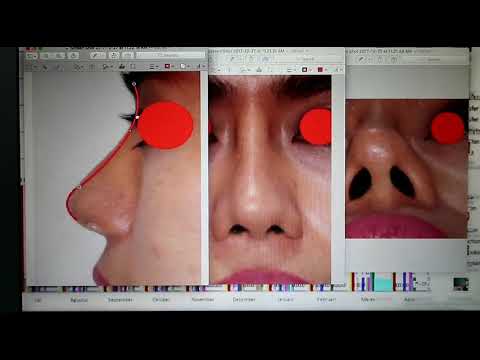 Bagaimana menemukan potensi lemah atau tidak Patogen perempuan termudah