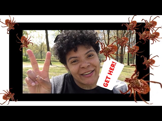 Video Pronunciation of Borrelia mayonii in English Video Pronunciation of Borrelia mayonii in English
