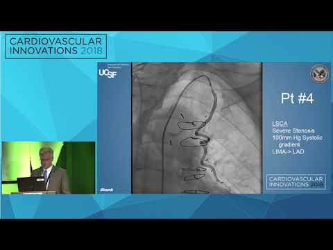 CVI2018 Session: Innovation in SVG interventions - Kendrick Shunk, MD