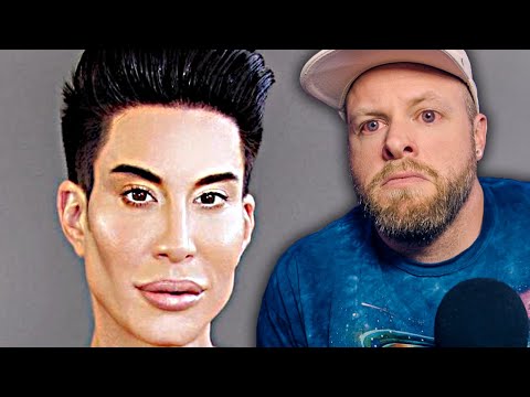 Cosmetic Surgery Addiction is OUT OF CONTROL