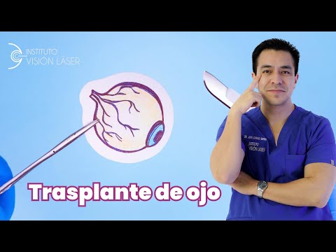 Trasplante de ojo