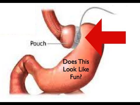 springfield il hypnotherapy