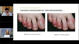 Webinar formativo “Covid y piel: un año después”