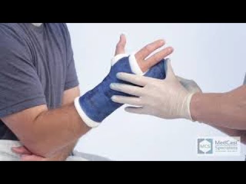 How to apply an ULNAR GUTTER (Boxer) Cast - Plus Cast Removal