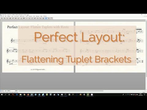 Perfect Layout for Finale®: Flattening Tuplet Brackets