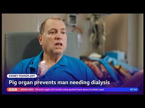 In a first, a pig kidney kept a patient alive until he got a human ...