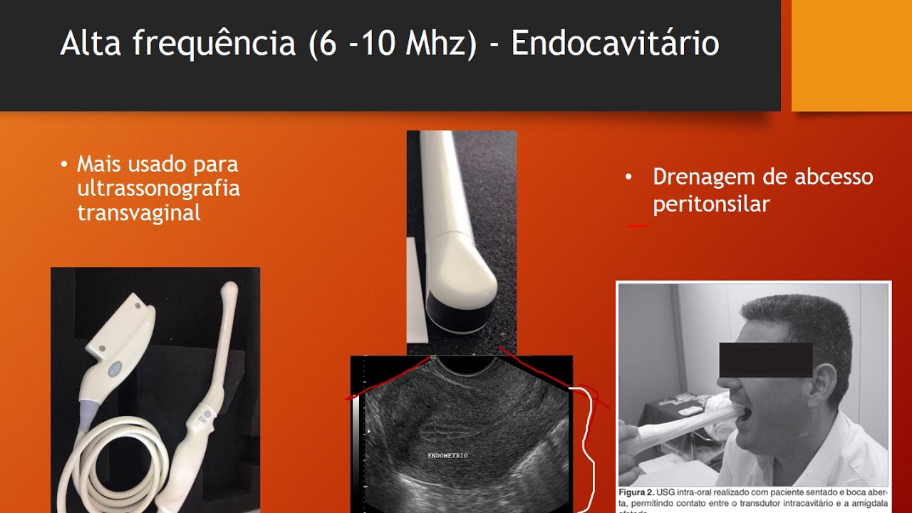 Simplificando o Uso do Ultrassom  - Como escolher o transdutor