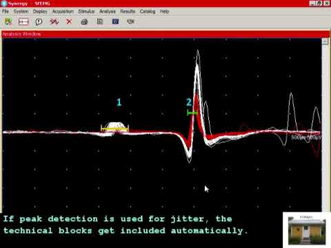 SFEMG - Technical Block  (Erik Stalberg)