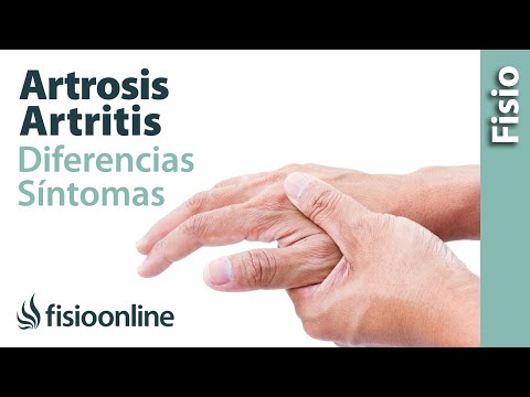 download lagu mp3 mp4 Artritis O Artrosis Diferencias, download lagu Artritis O Artrosis Diferencias gratis, unduh video klip Artritis O Artrosis Diferencias