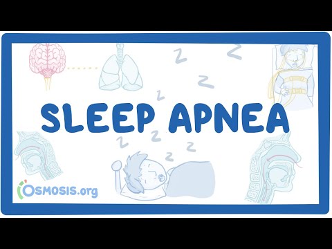 Sleep apnea - causes, symptoms, diagnosis, treatment, pathology