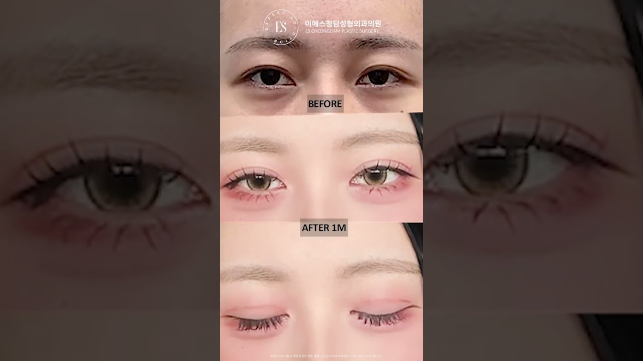 이에스 유튜브