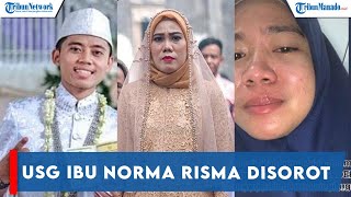 Download lagu HASIL USG IBU NORMA RISMA DISOROT, RIHANAH TAK TAHAN JAWAB KABAR HAMIL ANAK ROZY, 'MUDAH MUDAHAN' mp3