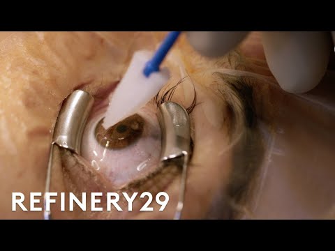 2nd YouTube video about are you awake during laser eye surgery