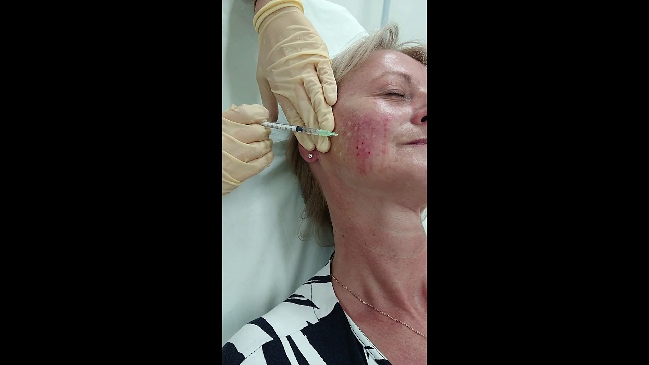 YouTube Video Preview