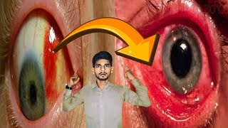 आंखों को पूरी तरह खराब कर देती है ये गलती जो 98% लोग रोज करते हैं जान लो नहीं तो पछताओगे.........