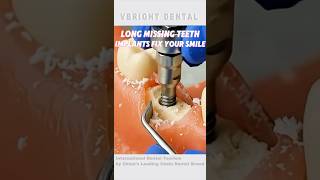 Had missing teeth for years? Dental implants can bring your smile back😄
